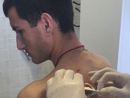 Младић који је рањен код Витине